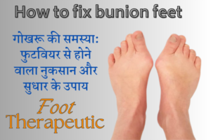 Bunion Feet