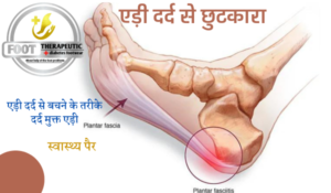 एड़ी दर्द से छुटकारा